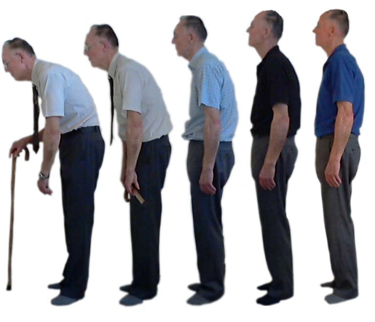 Causes Of Bad Posture