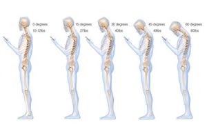 Why is good posture so important
