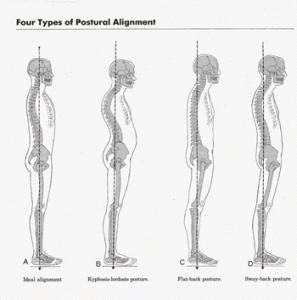 four types of posture